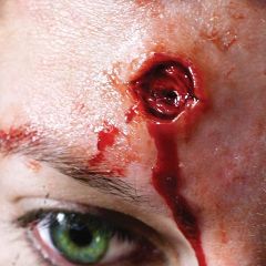 Kleine 3D-FX-overdrachten - met dop - ronde openwond